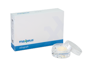 Website Photos 300x220 - Dappen Dish-01 (002)